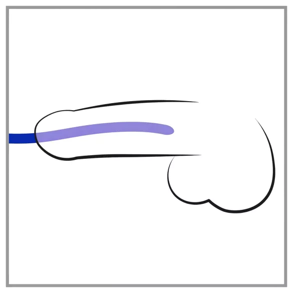 You2Toys - dilator set - 3 komada - silikon